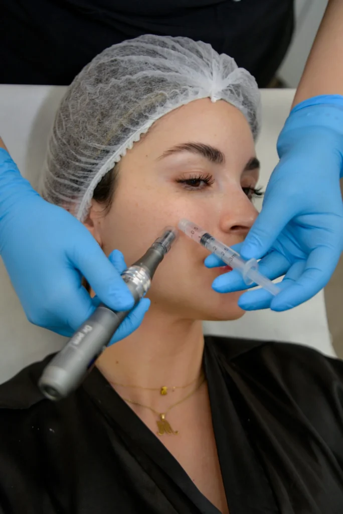 MESOTERAPIA-FACIAL-
